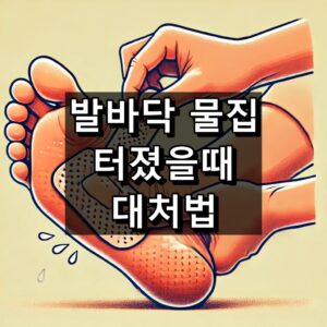 발바닥 물집 터졌을 때 대처법 대표 이미지